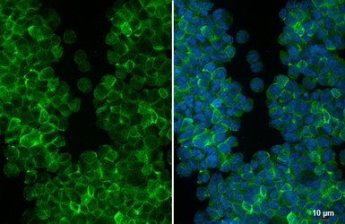Anti-EMR2 antibody [HL4420] used in Immunocytochemistry/ Immunofluorescence (ICC/IF). GTX643709